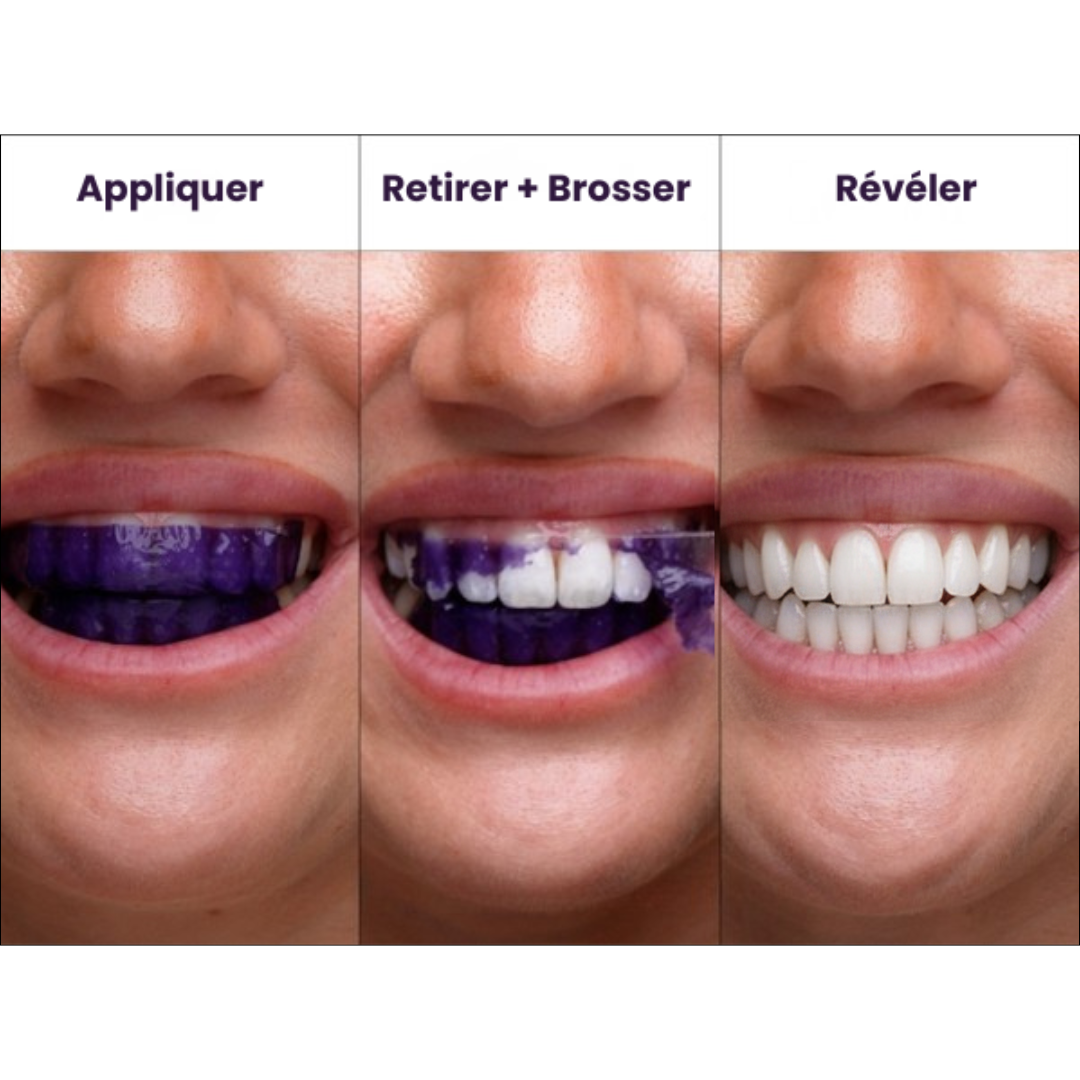 Bandes Blanchissantes Dents | Maroc | 100% BIO – COCOMULA ™ MAROC| Site Officiel | Produits Avancés De Blanchiment Des Dents à Domicile